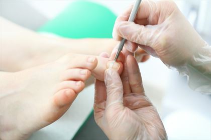 leczenie wrastających paznokci